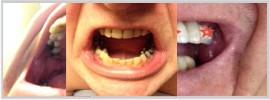 Photos of your dental situation